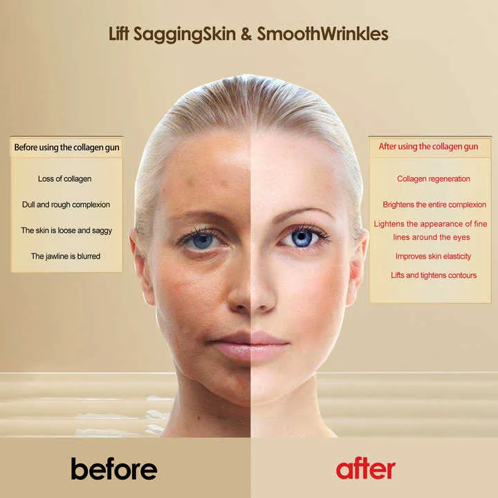 جهاز تجميلي لشد البشره - Skin tightening beauty device