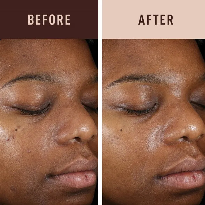 Fade Serum Retinol Hydroquinone-Free