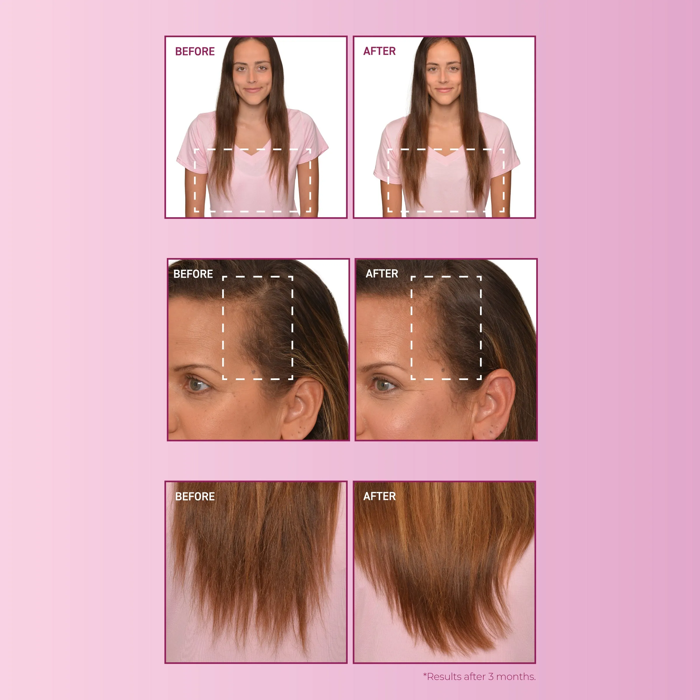 mendXtend Strengthening System for Longer, Fuller Hair