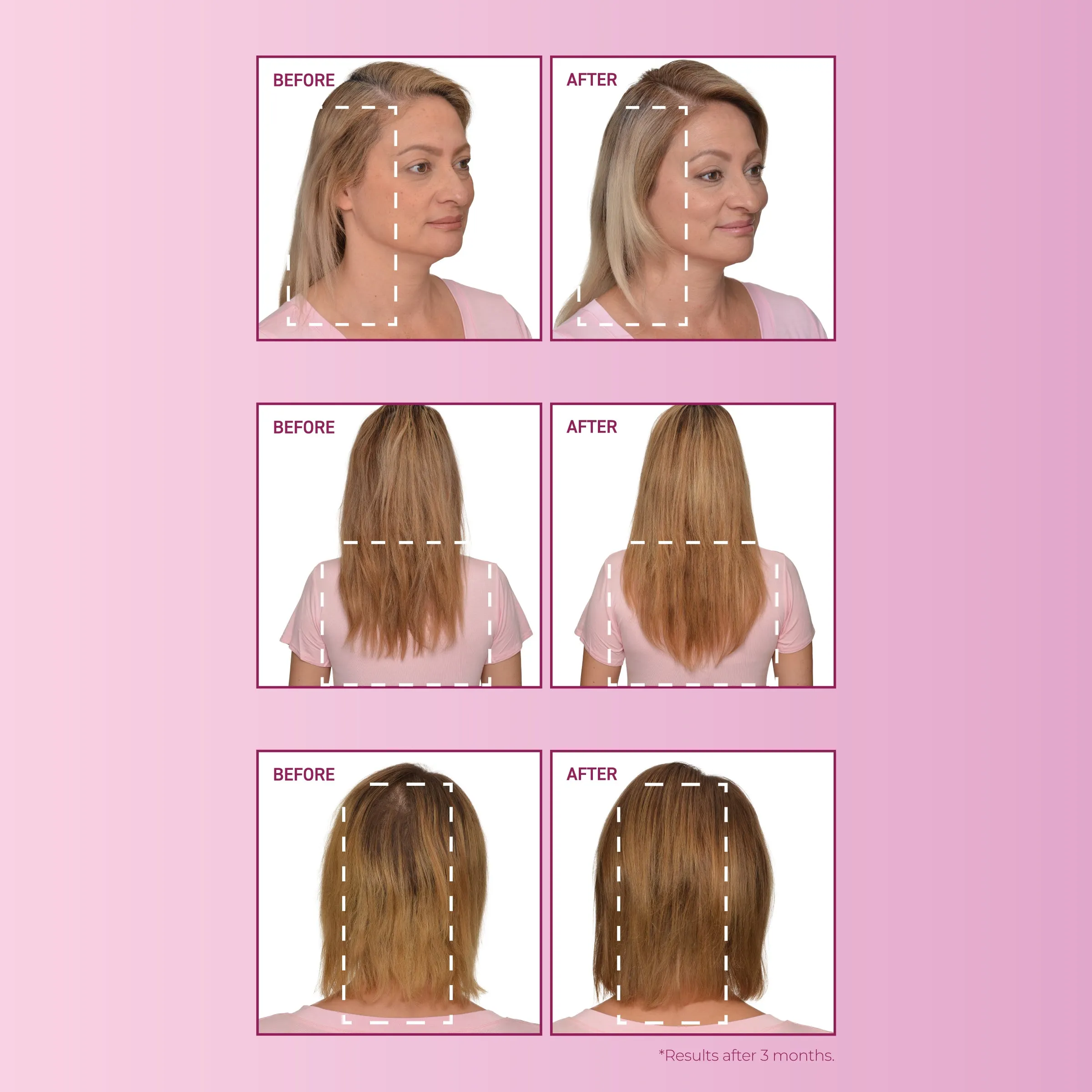 mendXtend Strengthening System for Longer, Fuller Hair