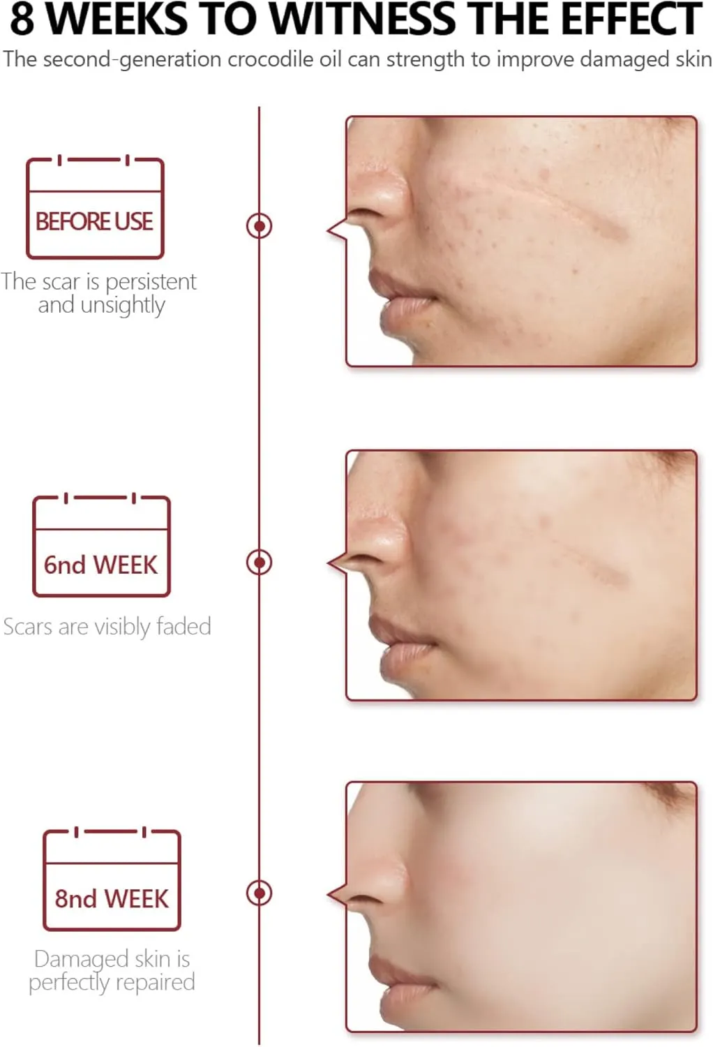 Scar Removal Serum