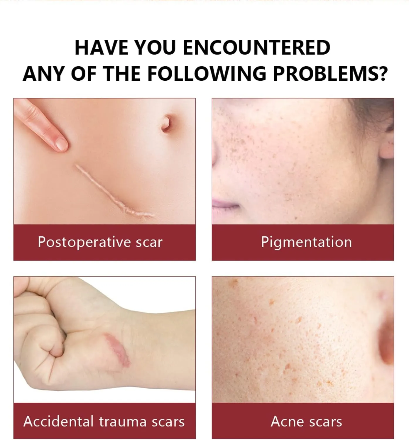 Scar Removal Serum